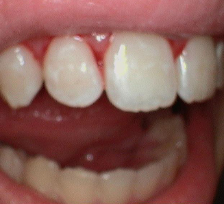Smile Gallery After Treatment
